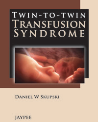 Twin-to-Twin Transfusion Syndrome 2013