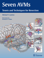Seven AVMs Tenets and Techniques for Resection