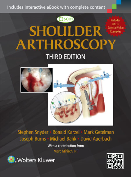 Shoulder Arthroscopy 3/E 2014