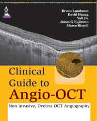 Clinical Guide to Angio-oct: Non Invasive, Dyeless Oct Angiography 2015