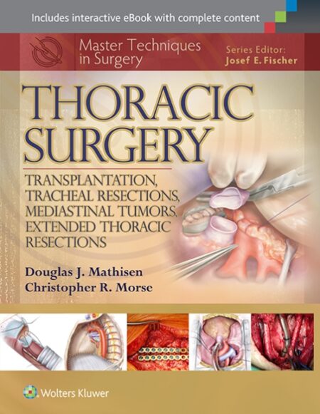 Master Techniques in Surgery: Thoracic Surgery: Transplantation, Tracheal Resections, Mediastinal Tumors 2015