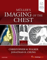 Muller's Imaging of the Chest: Expert Radiology Series 2/E 2019