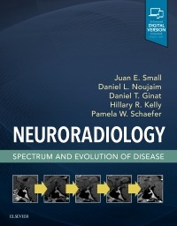 Neuroradiology: Spectrum and Evolution of Disease 2019