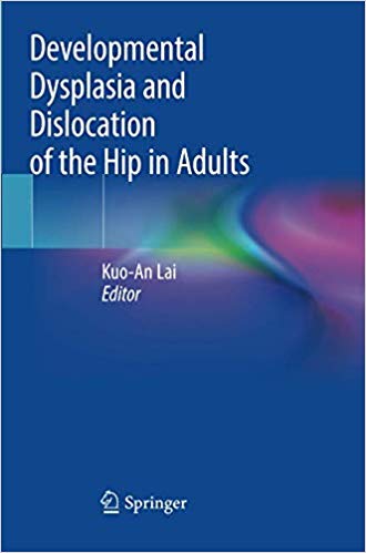 Developmental Dysplasia and Dislocation of the Hip in Adults 2019
