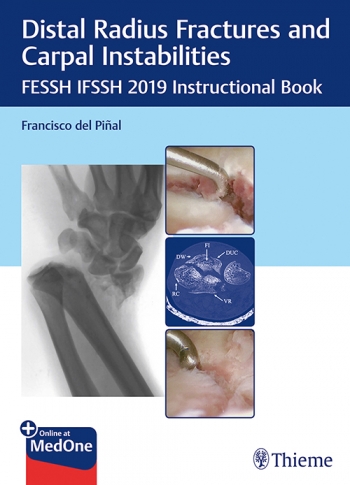 Microsurgical Management of Middle Ear and Petrous Bone Cholesteatoma 2019