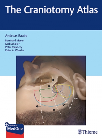 The Craniotomy Atlas 2019