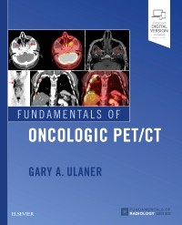 Fundamentals of Oncologic PET/CT 2019