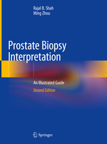 Prostate Biopsy Interpretation: An Illustrated Guide 2/E 2020