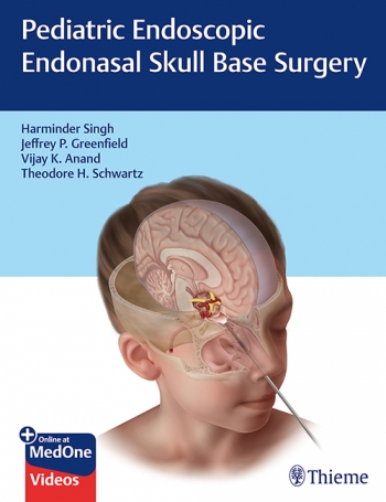Pediatric Endoscopic Endonasal Skull Base Surgery 2020