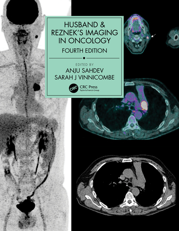 Husband & Reznek's Imaging in Oncology 4/E 2021
