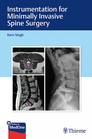 Instrumentation for Minimally Invasive Spine Surgery 2021