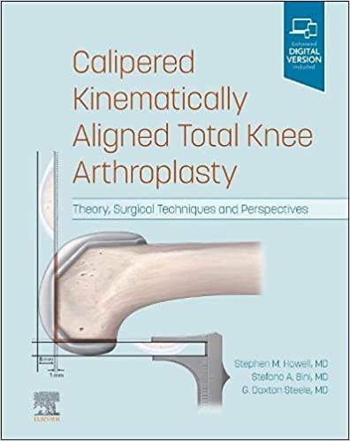 Calipered Kinematically aligned Total Knee Arthroplasty: Theory, Surgical Techniques and Perspectives 2022
