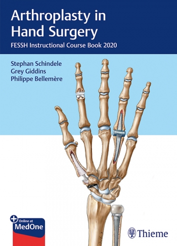 Arthroplasty in Hand Surgery :FESSH Instructional Course Book 2020   2021