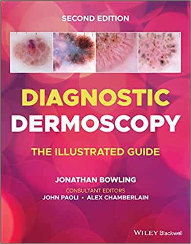 Diagnostic Dermoscopy: The Illustrated Guide 2/E 2022